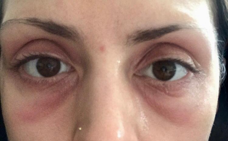 ole henriksen dark circles