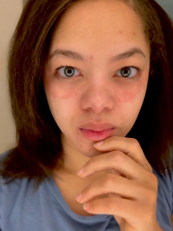 Ole Henriksen Banana Eye Cream Before And After Banana Poster