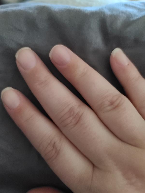 Right hand after 1 wk of Nail Envy