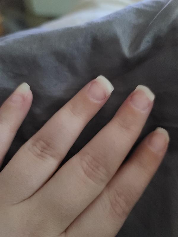 Left hand after 1 wk of Nail Envy