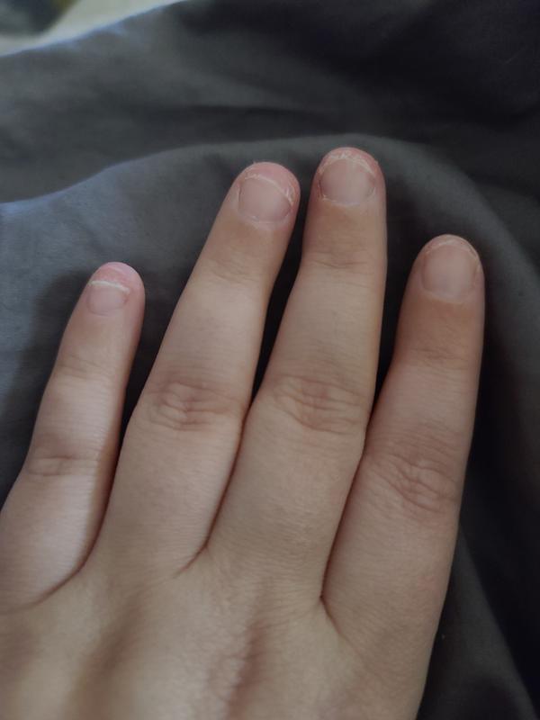 Have to cut them so low to grow back correctly