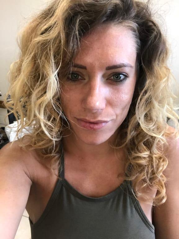 Skin before, no make up