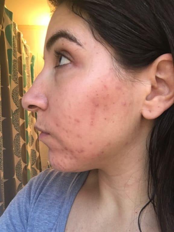 BEFORE - FEELING GROSS