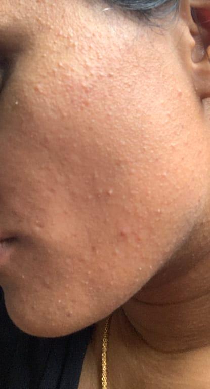 After using this product