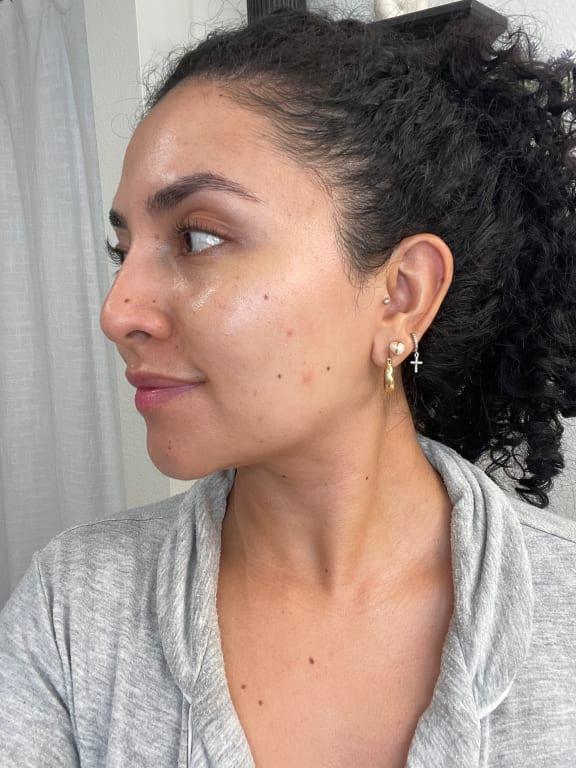 After apply the cream