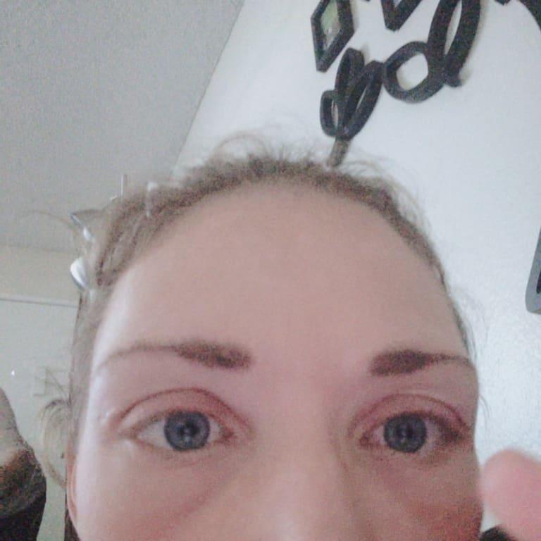 this is a close up of using this product daily 2X a day to be exact for 2 weeks straight.