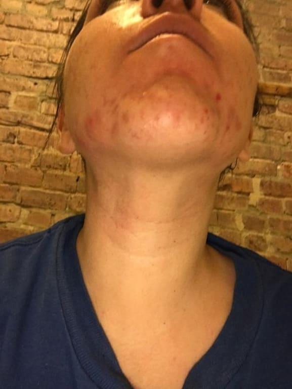 BEFORE - NOT CONFIDENT