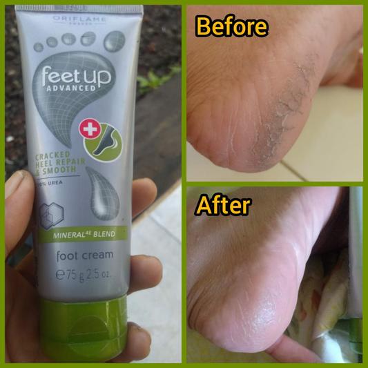 Feet up advanced hot sale foot cream