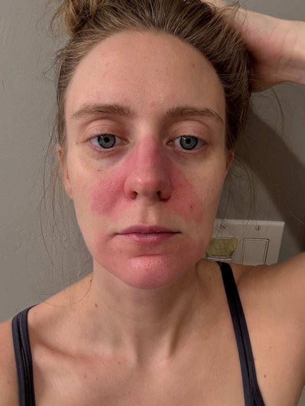 Review Thumbnail Image 0 378988994