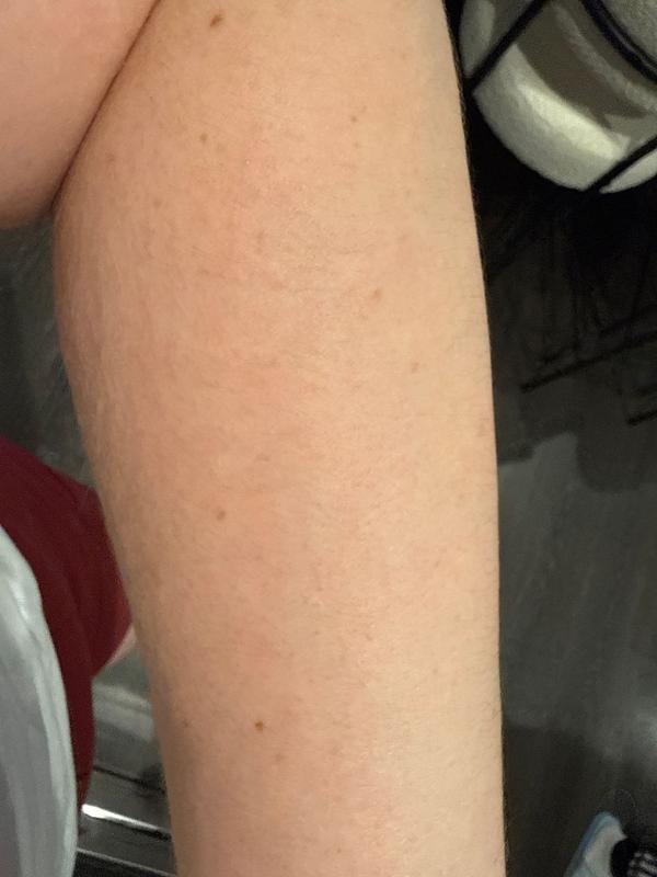 Customer photo for "Rash after using for 3 days"