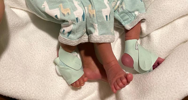 Smart Sock Baby Monitor – Owlet Australia