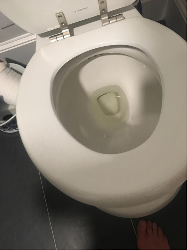 Principal 136+ imagen why is my toilet seat turning blue not pregnant