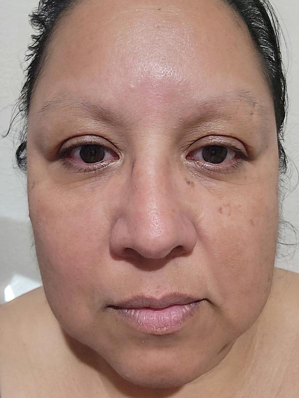 Week 2