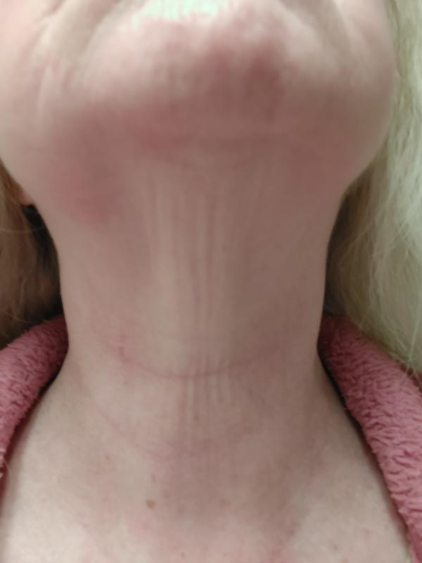 Photo - commentaire&nbsp;2