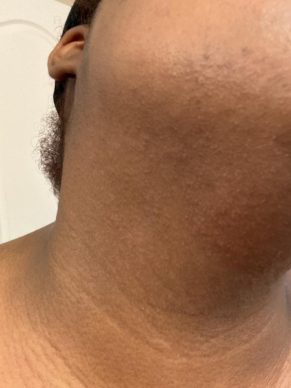 Chin and neck