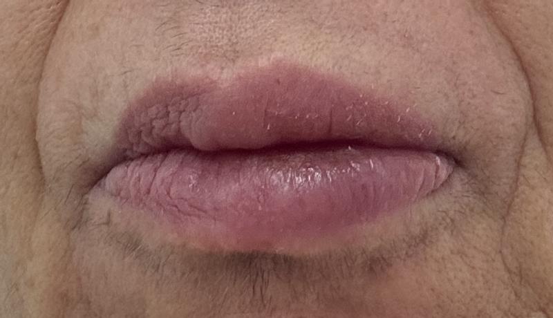 the way my lips became after the lipstick use
