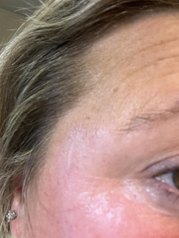 Crows feet minimized!