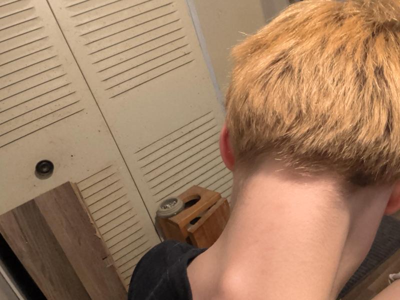 Before and