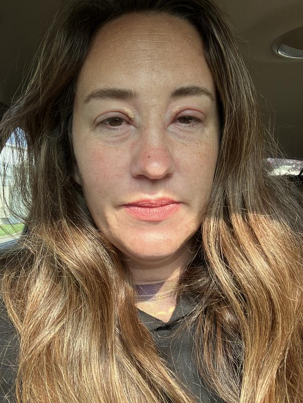 These are before and after photos.