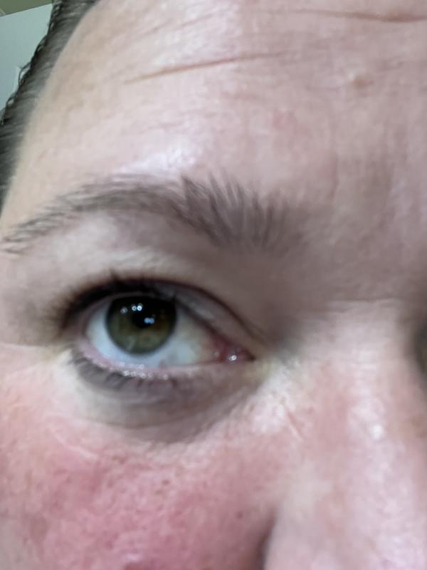 Crows feet before
