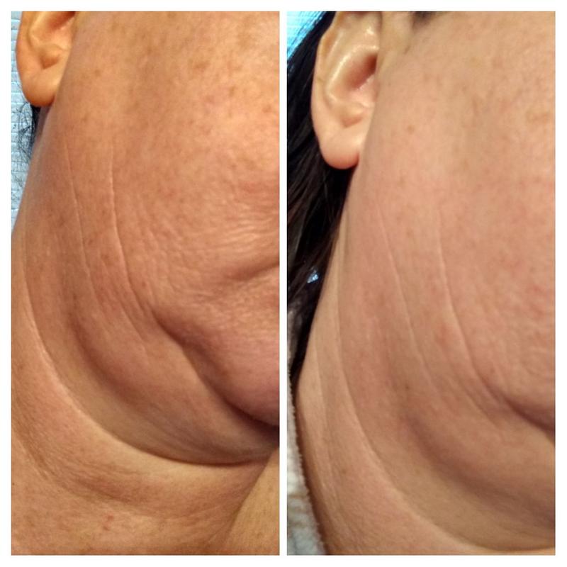 Amazing results