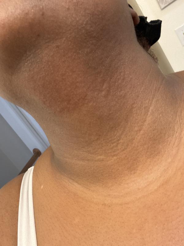 Chin and neck