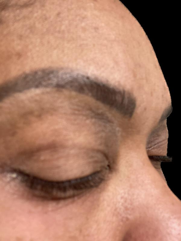 Top eyelid dark ! I have video not sure y it’s not uploading