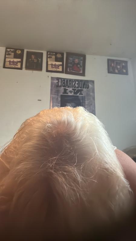 My hair after bleaching