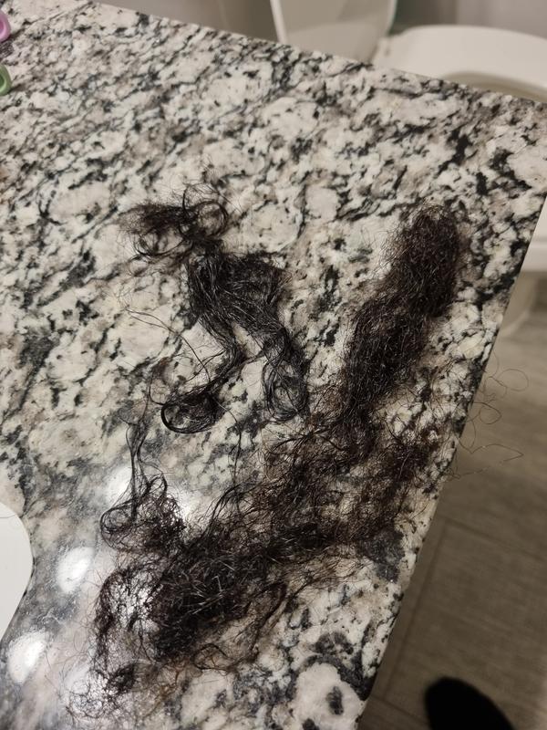Hair fall out