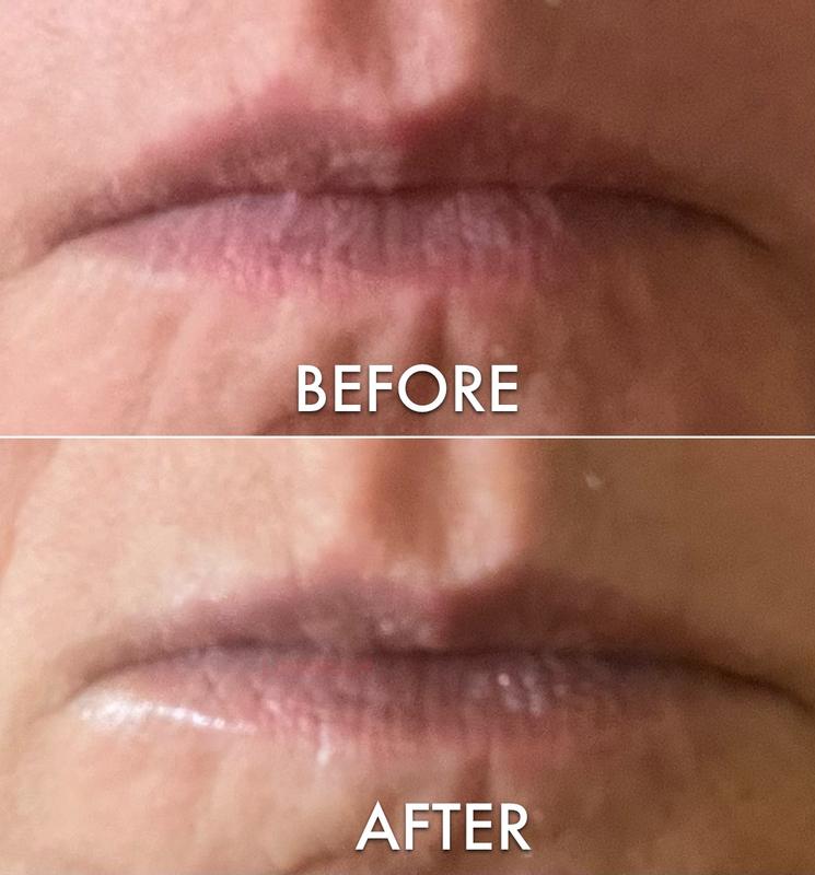 Before & After