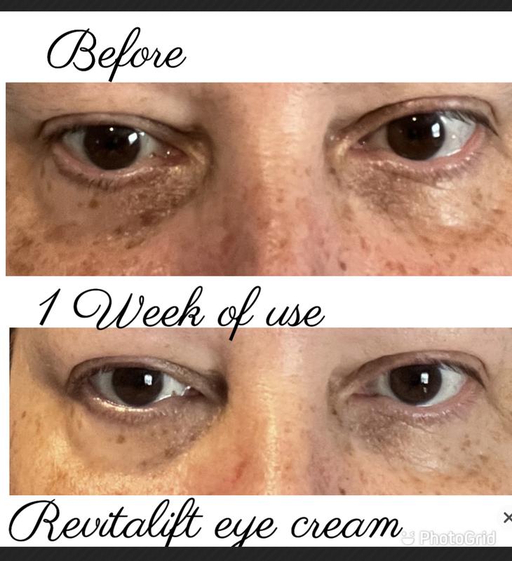 Loreal Eye Lifting Serum Reviews Cheapest Order