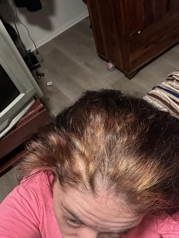 My hair after applications were applied