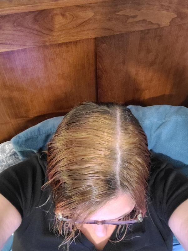 My natural dark brown hair got bleached. The intent of this product was to remove the portion of my hair that had hair dye in it.