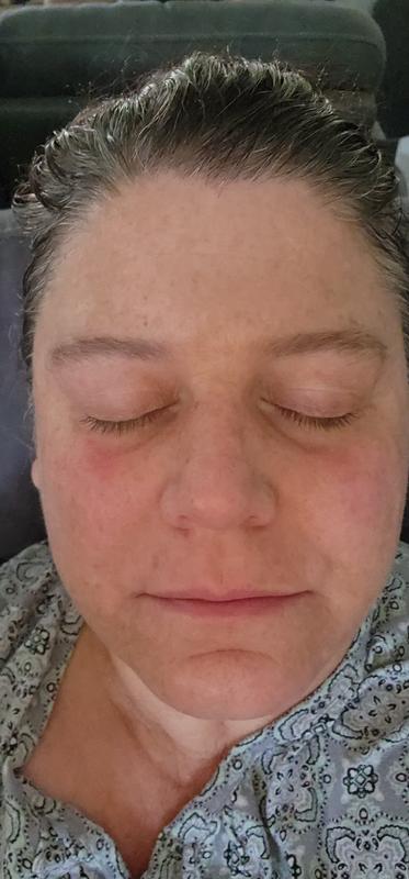 A bit red, but I believe that's normal, right?