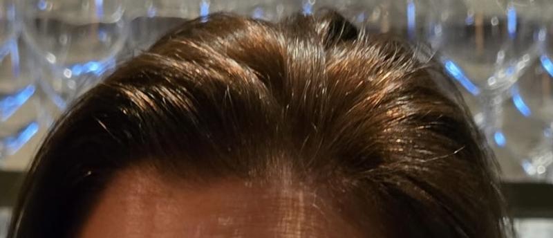 Hot roots