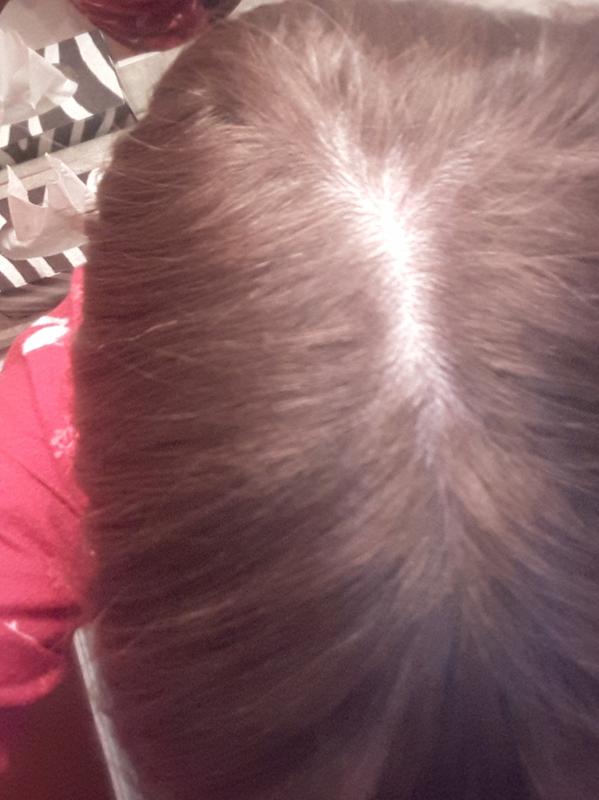 Before touch up