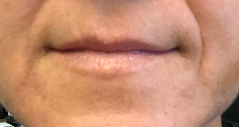 Lychee Plump and Shine #trywithtopbox