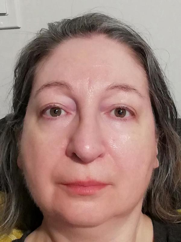 Wrinkles are softened and less visible