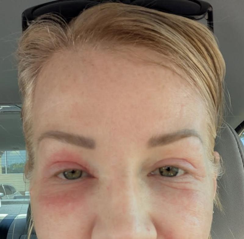 How it started vs finally able to leave the house after three days.