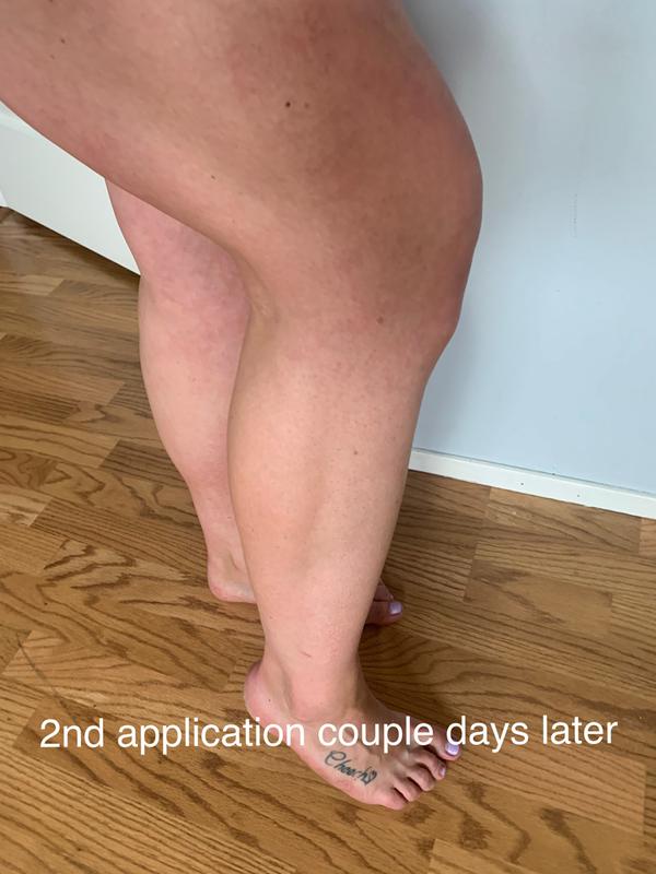 2nd application #tryitwithtopbox