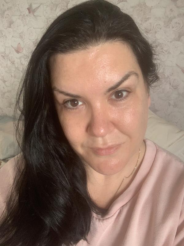 Hydrated skin
