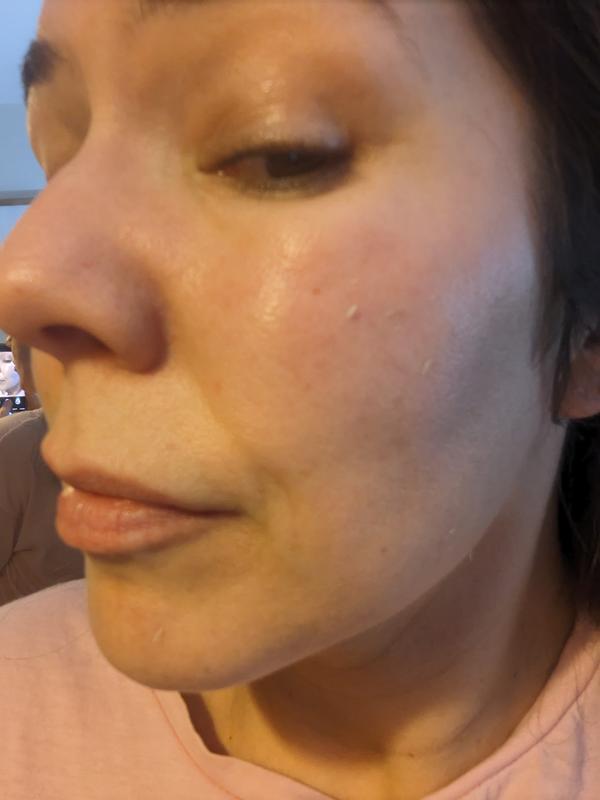 Face cream peels off into little balls