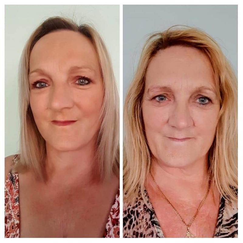 After and before look .