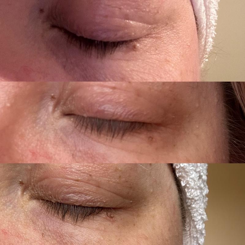 From top to bottom- before use, 4 weeks and 8 weeks