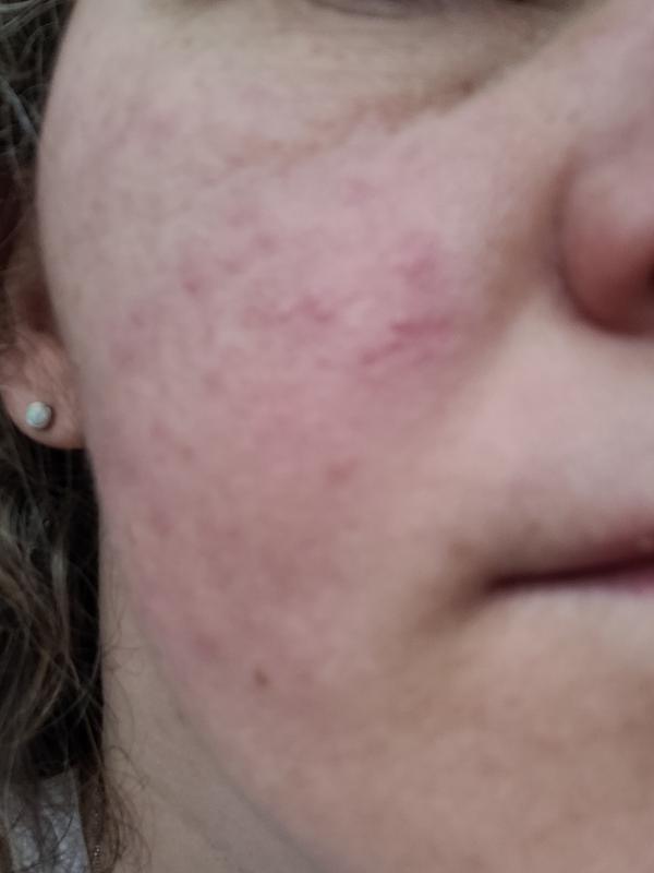 Face after using face cream