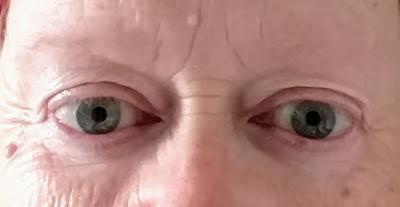 Before using Age Perfect Eye Cream