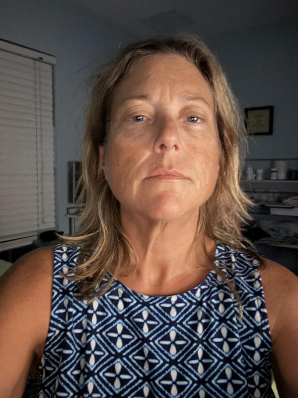 The start before pic