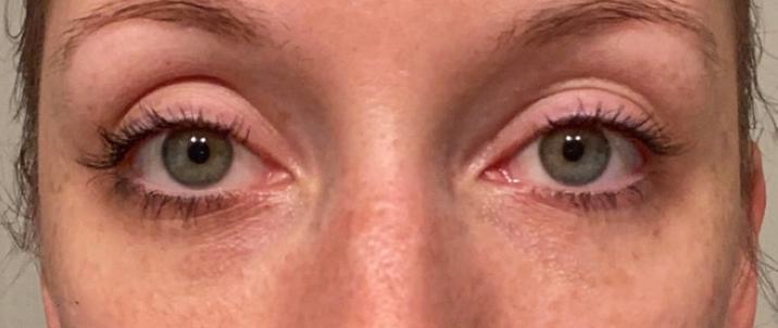 lancome progres eye cream discontinued