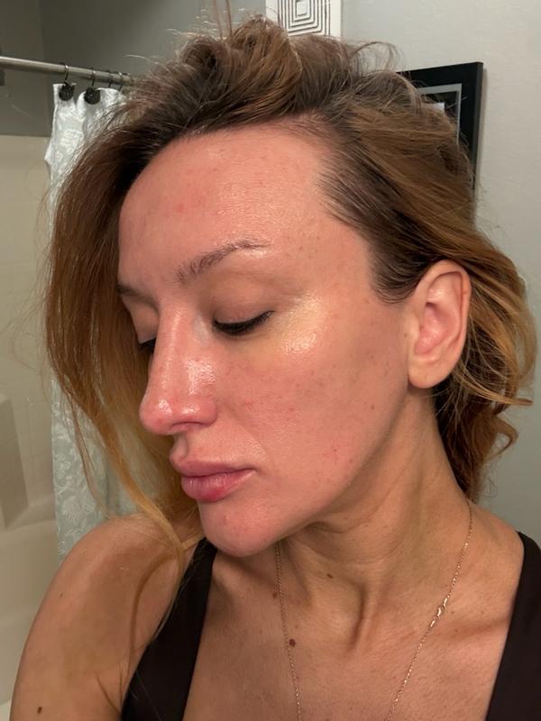 Review Thumbnail Image 0 385315659