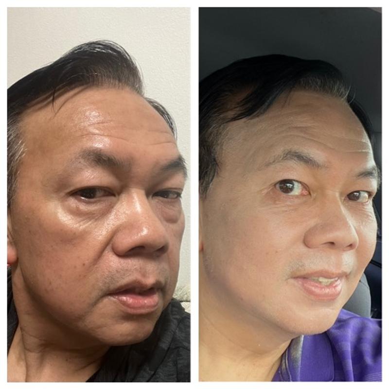 Smooth fine lines and wrinkles